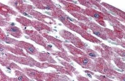 Immunohistochemistry-Paraffin: PAC1R Antibody [NBP3-14442]